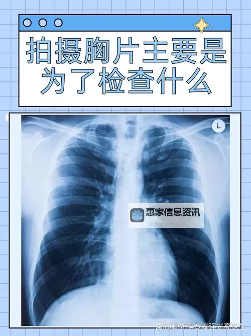 【最新推荐】100胸片曝光率软件免费无病毒,安全高效助您诊断无忧图1