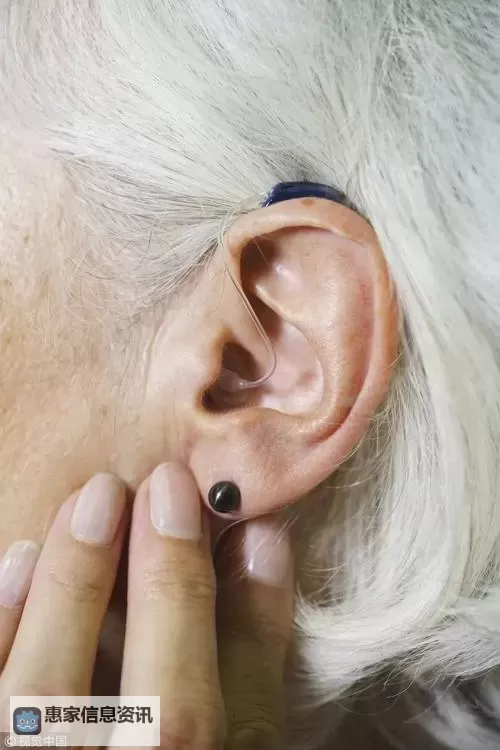 轻松教程:棉签加冰块免费视频教你快速缓解耳痛图1