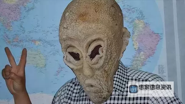 中国9人疑似外星人引发热议:真相尚待揭晓图1