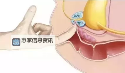如何找到可靠的“走后门的正确方法图片”指南图2