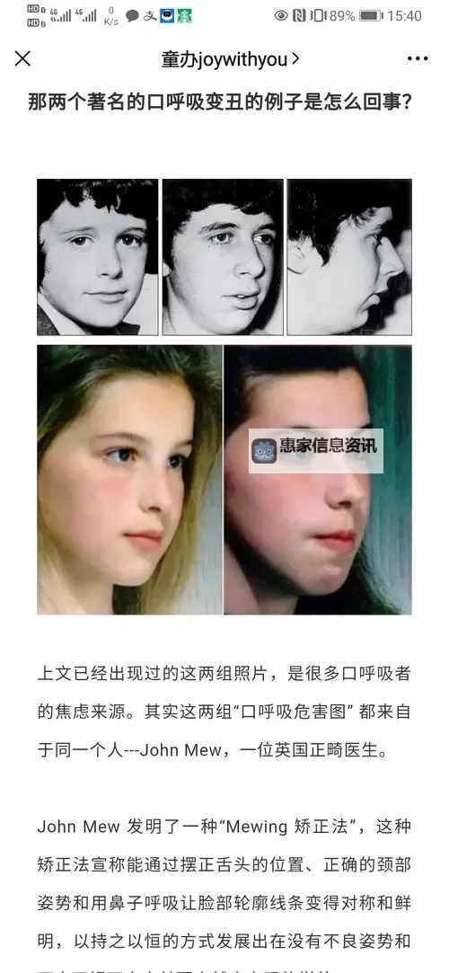 张嘴伸舌头呼吸原声:探索呼吸与发声的自然之声图1